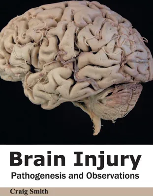 Produktbild von Brain Injury