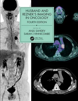 Produktbild von Husband & Reznek's Imaging in Oncology