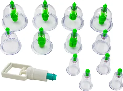 A set of cupping therapy tools, including multiple transparent cups with green valves and a white pump, arranged on a white background.
