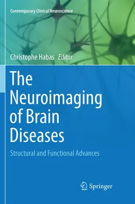 Obrázok produktu pre The Neuroimaging of Brain Diseases