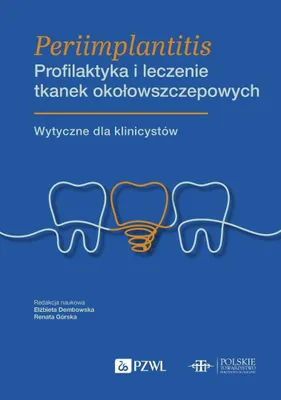 Obrázek produktu pro Periimplantitida. Prevence a léčba tkáně...
