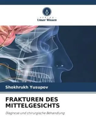 Produktbild von Frakturen Des Mittelgesichts