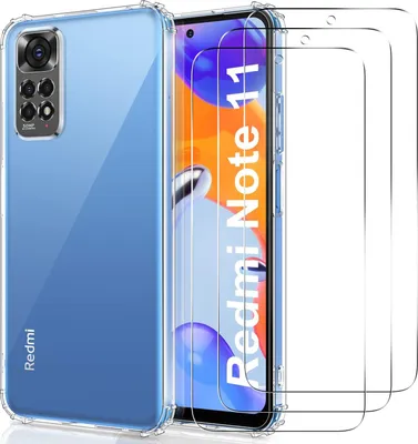 Immagine prodotto di Custodia protettiva in silicone per Xiaomi Redmi Note 11/11S + 3 protezioni in vetro temperato