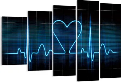 Produktbild von Bild auf Leinwand - Leinwandbild - Grafik herz kardiologie - 150x100cm - Wand Bild - Wanddeko - Leinwanddruck - Bilder - Kunstdruck - Wanddekoration - Leinwand bilder - Wandkunst - EG150x100-0959