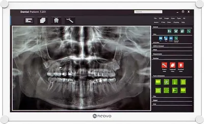 Zdjęcie produktu dla AG Neovo DR-2202, 54,6 cm (21.5"), 1920 x 1080 px, Full HD, LED, 5 ms, Biały