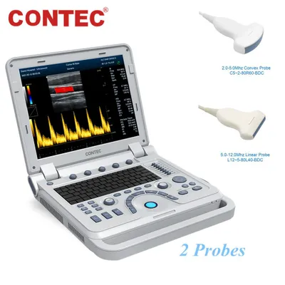 Immagine prodotto di Ecografo portatile con Doppler a colori e 2 sonde (convessa e lineare) CMS1700B