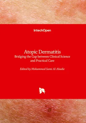 Produktbild von Atopic Dermatitis - Bridging the Gap between Clinical Science and Practical Care