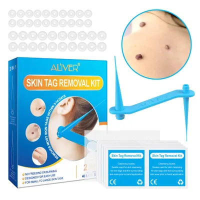 Produktbild von Stielwarzen Entferner Anti Stielwarze Warzenentferner Skin Tag Removal Set 2-in-1