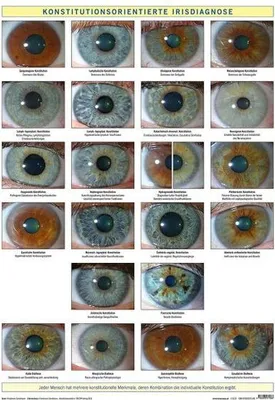 Immagine prodotto di Garvelmann, F: Konstitutionsorientierte Irisdiagnose