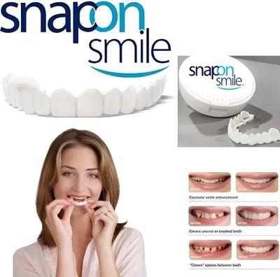 Produktbild von Abnehmbare Zahnverblendungen Snap On Smile Set oben und unten
