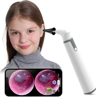 Produktbild von Kabelloses HD-Otoskop,720P Digitales Otoskop mit Beleuchtung – Kabellos, Gyroskopkamera, 6 LEDs, ideal für Ohrreinigung zu Hause