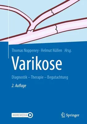 Image de Varikose