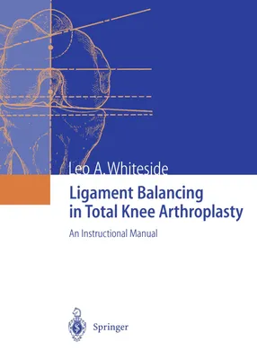 Produktbild von Ligament Balancing in Total Knee Arthroplasty