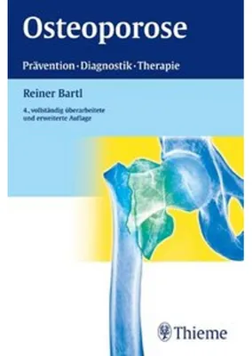 Obrázek produktu pro Osteoporose