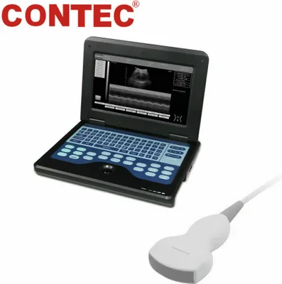 Produktbild von CMS600P2 Tragbarer 10,1-Zoll-Laptop B-Ultraschall-Diagnosesystem Digitales Ultraschall-Scanner Ultraschallgerät mit konvexer 3,5-MHz-Sonde