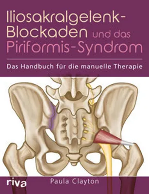 Obrázok produktu pre Iliosakralgelenk-Blockaden und das Piriformis-Syndrom
