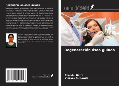 Produktbild von Regeneración ósea guiada