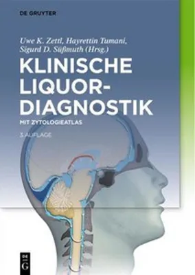 Produktbild von Klinische Liquordiagnostik