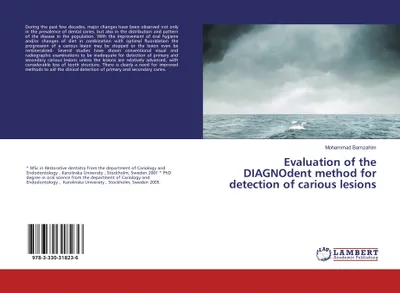 Produktbild von Evaluation of the DIAGNOdent method for detection of carious lesions