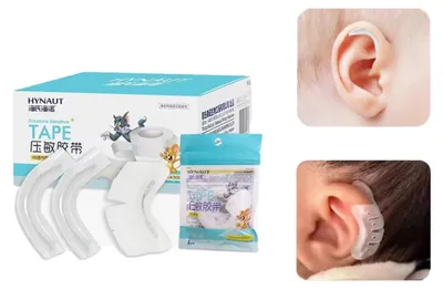 Obrázok produktu pre Korekčná pomôcka, silikónový materiál, pohodlná nositeľnosť, D