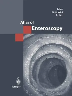 Produktbild von Atlas of Enteroscopy