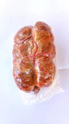 Scharfe kalabrische Soppressata