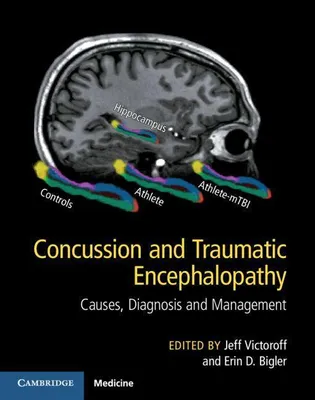 Produktbild von Concussion and Traumatic Encephalopathy