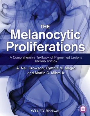 Produktbild von Crowson, A: Melanocytic Proliferations