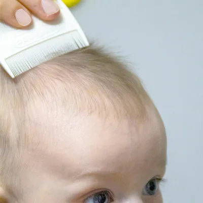 Produktbild von Babyjem Milchschorf-Kamm für Neugeborene – Feiner Baby Kamm zur sanften Kopfhaut-Pflege