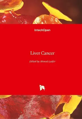 Produktbild von Liver Cancer