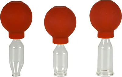 Productafbeelding van Glazen set van 3 cuppingglazen met bolletje, verkrijgbaar in de maten 10-15-20 mm. Geschikt voor professioneel gebruik, medische toepassingen en cupping zonder vlam. Handgeblazen en met de hand gevormd – het origineel