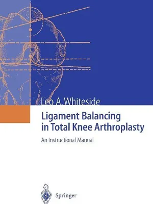 Produktbild von Ligament Balancing in Total Knee Arthroplasty
