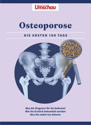 Produktbild von Apotheken Umschau: Osteoporose