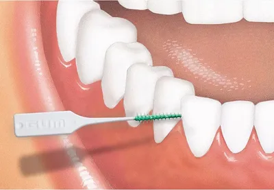 Zdjęcie produktu dla GUM 6991, SS-M, Termoplastyczny elastomer, Polipropylen (PP), 40 szt., Blister