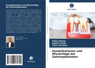 Produktbild von Komplikationen und Misserfolge bei Zahnimplantaten