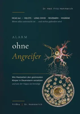 Produktbild von Alarm ohne Angreifer: MCAS bei ME/CFS, Long Covid, Reizdarm und Migräne
