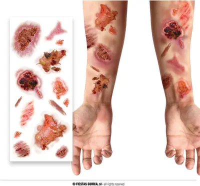 Imagen del producto de Tatuajes Con Heridas Infeccionadas, 30X13 Cm