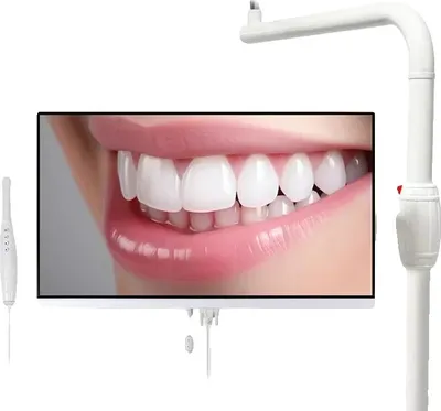 Immagine prodotto di Endoscopio, telecamera intraorale dentale a 6 LED, 12 milioni di pixel, monitor da 24 pollici, spina UE da 45 mm