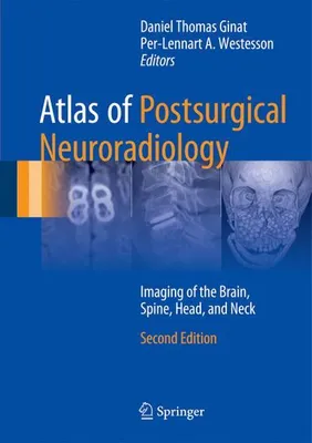 Produktbild von Atlas of Postsurgical Neuroradiology