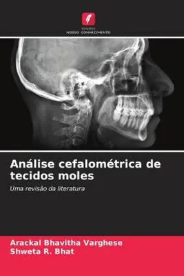 Produktbild von Análise cefalométrica de tecidos moles