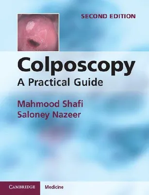 Produktbild von Colposcopy