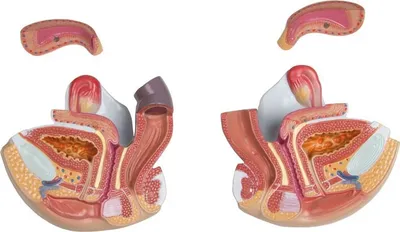 Two anatomical models of the male pelvic region are shown side-by-side against a white background. Each model is a cross-section, revealing internal organs and structures. A separate piece, likely a removable section of the model, is positioned above each 
