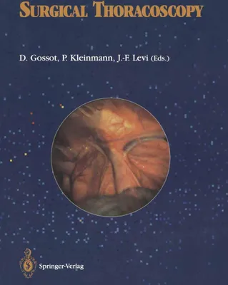 Produktbild von Surgical thoracoscopy