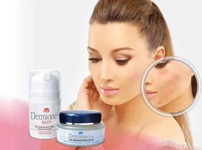 Immagine prodotto di Dermione® - KIT PER LA CURA DELLA PELLE TENDENTE ALL'ACNE E AI PRIMI SEGNI DI INVECCHIAMENTO
