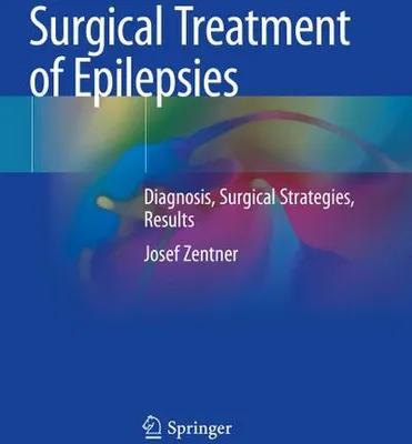 Zdjęcie produktu dla Surgical Treatment of Epilepsies