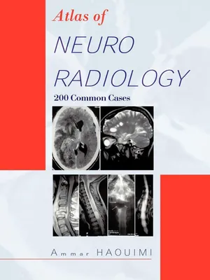 Produktbild von Atlas of Neuroradiology