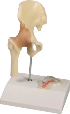 Immagine prodotto di Modello in miniatura dell'articolazione dell'anca con sezione trasversale