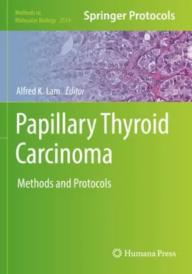 Obrázek produktu pro Papillary Thyroid Carcinoma