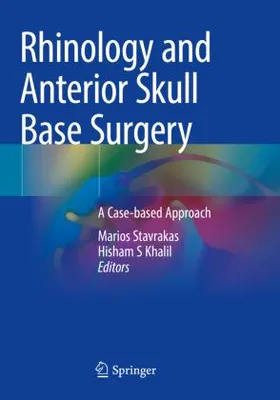 Zdjęcie produktu dla Rhinology and Anterior Skull Base Surgery