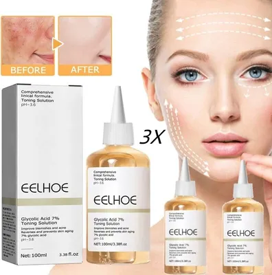 Produktbild von 3 Stück Gesichtswasser, Glykolsäure 7% Tonisierungslösung, entfernt Akne, hellt Akneabdrücke auf, spendet der Haut Feuchtigkeit, 300ml
